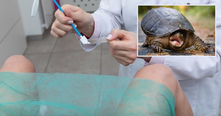 Врачи нашли в вагине британки мертвую черепашку